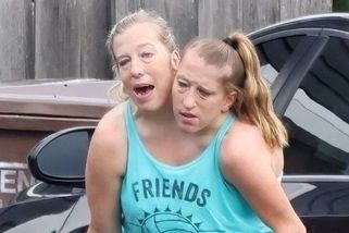 Slavná siamská dvojčata se objevila na veřejnosti s novorozencem - Novinky